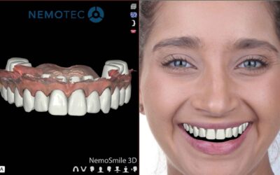Digital smile design: aesthetic planning integrated into the clinical workflow