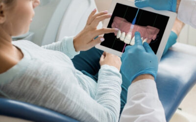 What is an intraoral scanner (IOS) and what is it used for in digital dentistry?