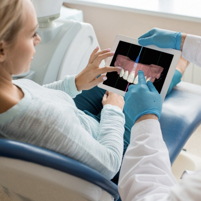 que es un escaner intraoral (6)