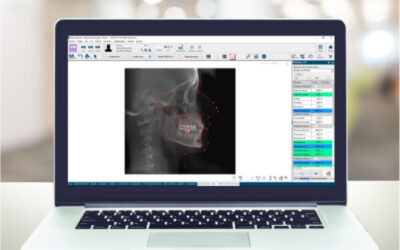 Cephalometric analysis in orthodontics: what it is, what it is used for, and how to integrate it into a digital workflow (2D/3D + AI)