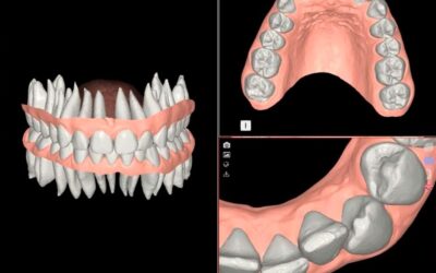 Set up dental: cómo planificarlo bien antes de empezar el tratamiento