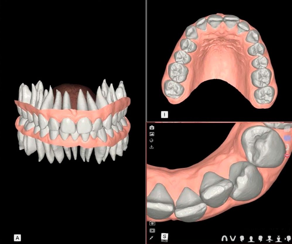 set up dental