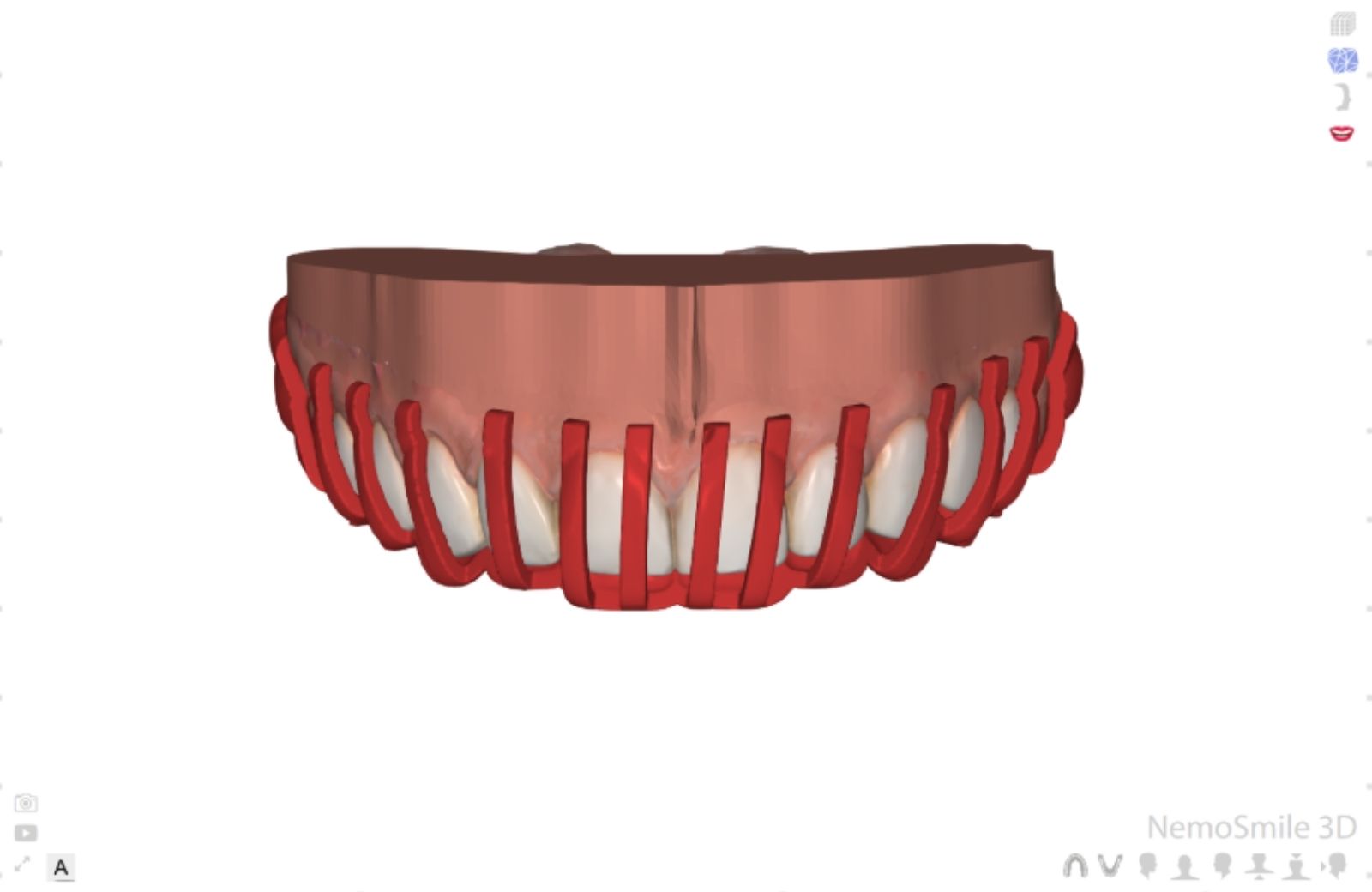 Encerado digital dental